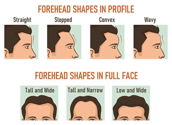 forehead shapes in profile for forehead fillers